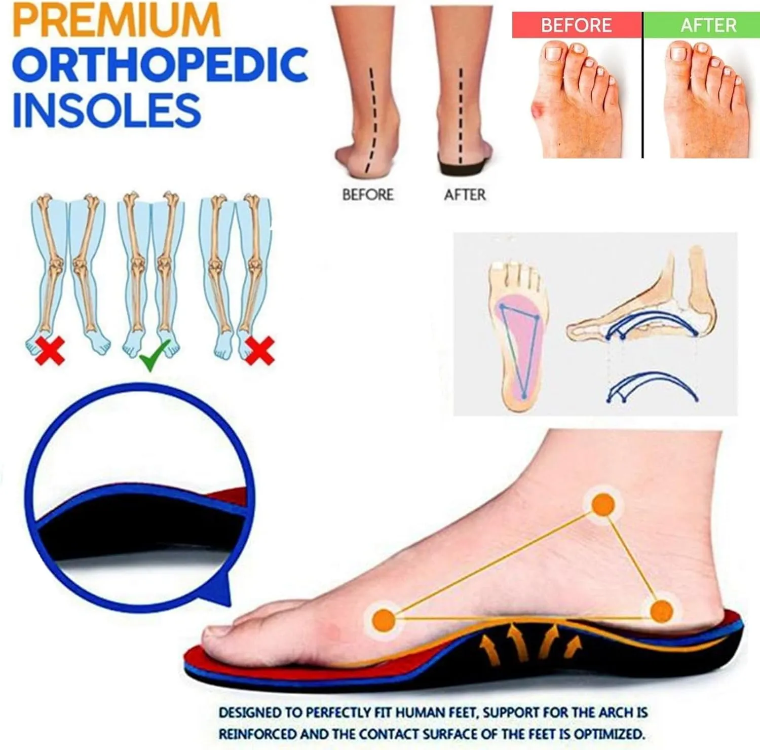 Clogs for Women 2025 Arch Support Orthopedic Sandals Wide Width Wedge Sandals Bow Hollow Breathable Platform Wedge Sandal Outdoor Beach Slippers Closed Toe Slippers